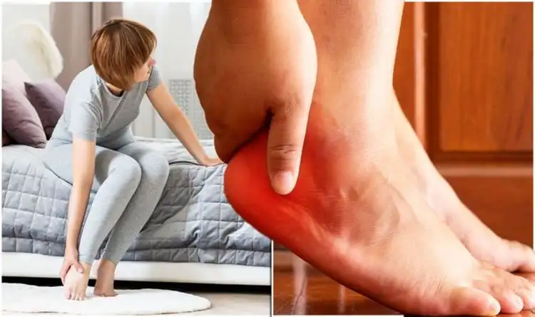 علاج النقرس وأعراضه وأسباب حدوثه .. 7 طرق علاجيه من المنزل